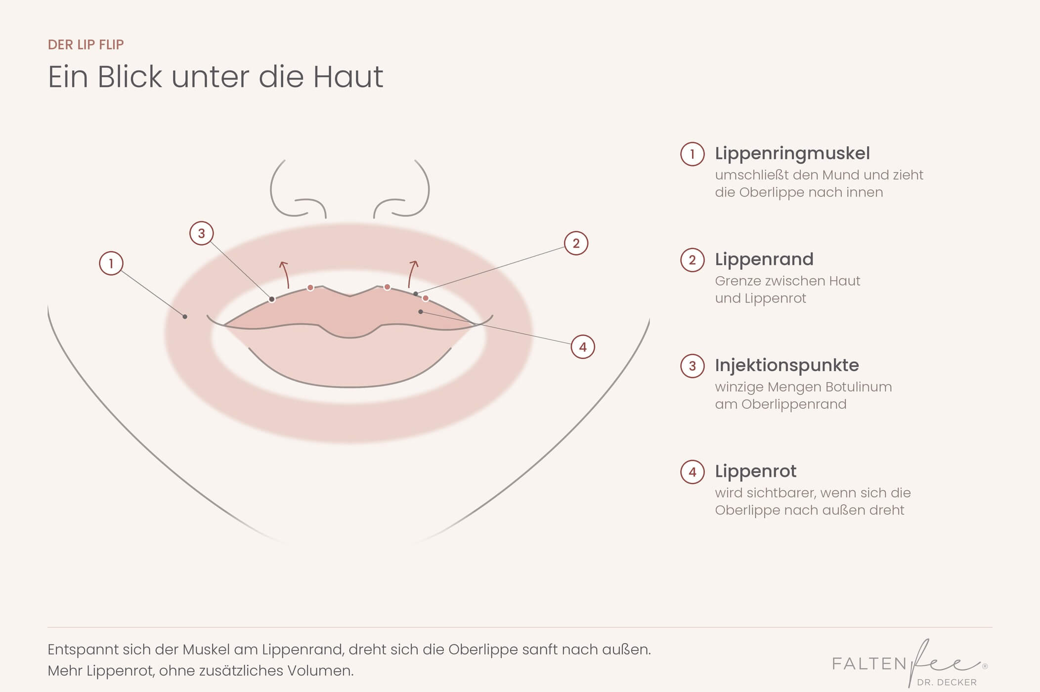 Schematische Darstellung des Lip Flips mit Botulinum: Lippenringmuskel, Lippenrand und Injektionspunkte an der Oberlippe – FALTENFEE® Dortmund